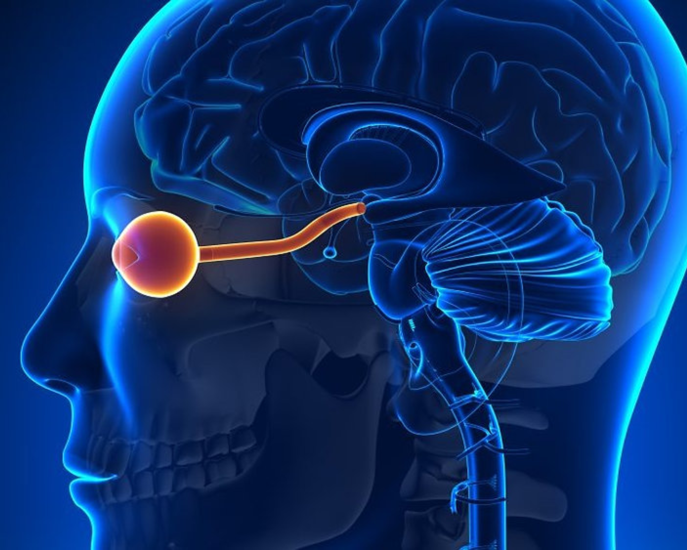 Neuromielite Óptica