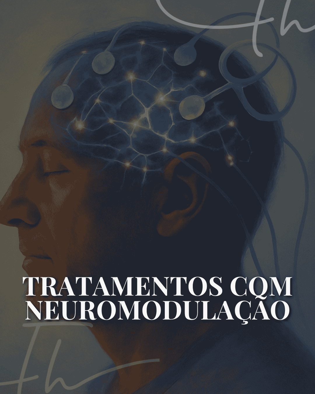 Tratamentos com Neuromodulação