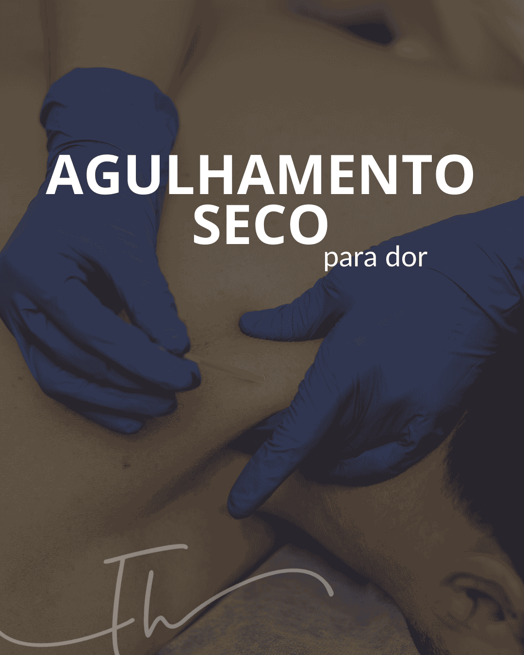 agulhamento seco para dor